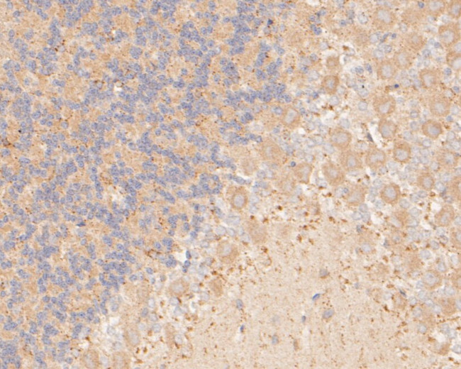 P2X7 Antibody in Immunohistochemistry (Paraffin) (IHC (P))