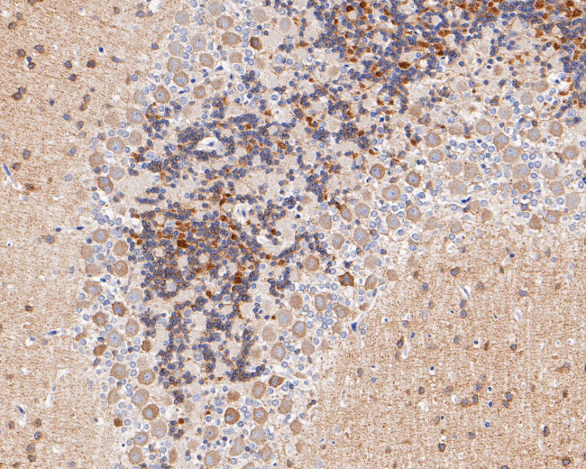 GABRA1 Antibody in Immunohistochemistry (Paraffin) (IHC (P))