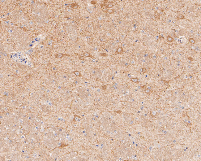 GABRA1 Antibody in Immunohistochemistry (Paraffin) (IHC (P))