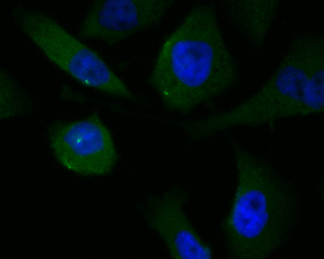 KCNMA1 Antibody in Immunocytochemistry (ICC/IF)