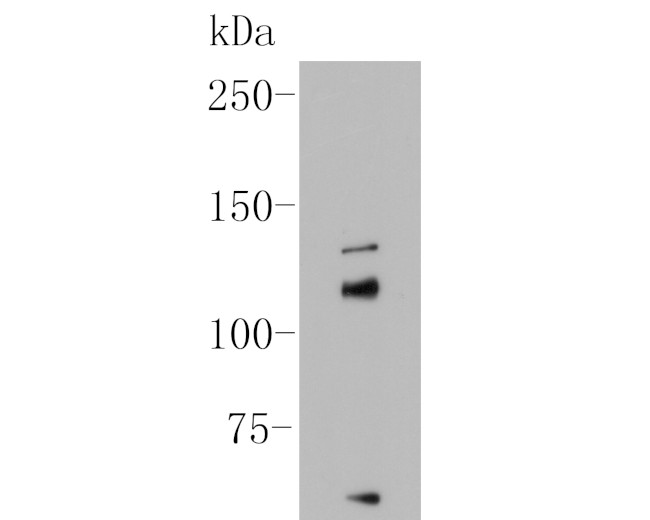 KCNMA1 Antibody in Western Blot (WB)