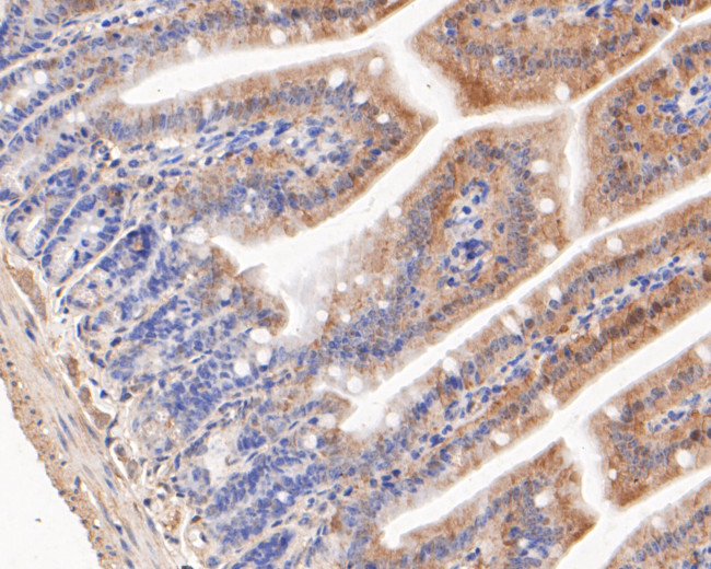 KCNMA1 Antibody in Immunohistochemistry (Paraffin) (IHC (P))