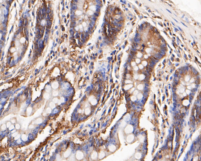 KCNMA1 Antibody in Immunohistochemistry (Paraffin) (IHC (P))