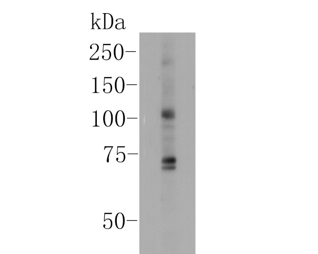 KCNMA1 Antibody in Western Blot (WB)