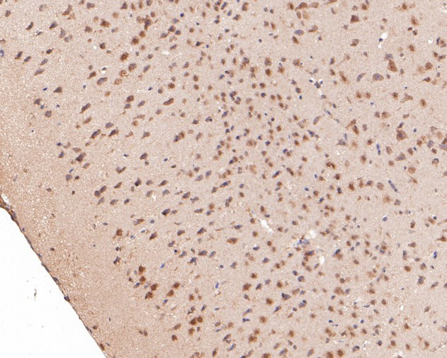 DNMT3A Antibody in Immunohistochemistry (Paraffin) (IHC (P))