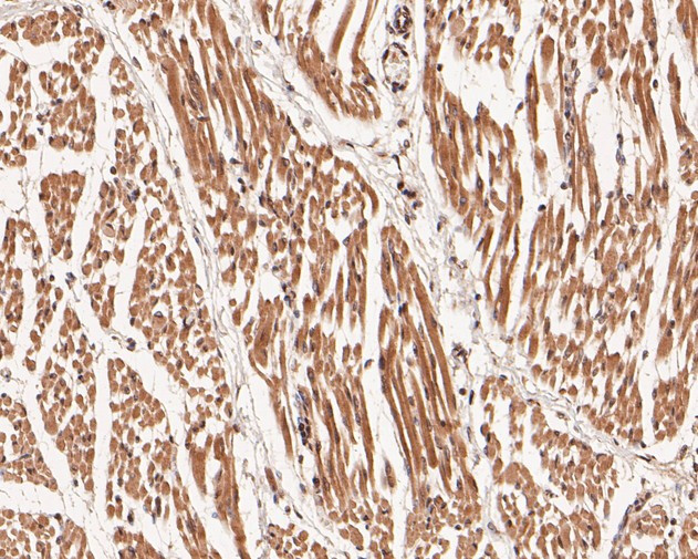 DNMT3A Antibody in Immunohistochemistry (Paraffin) (IHC (P))