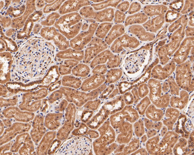 DNMT3A Antibody in Immunohistochemistry (Paraffin) (IHC (P))