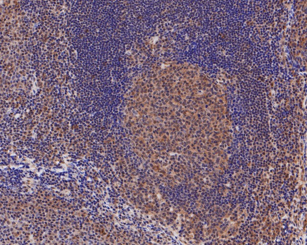 DNMT3A Antibody in Immunohistochemistry (Paraffin) (IHC (P))