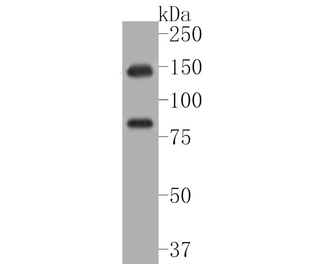 DNMT3A Antibody in Western Blot (WB)