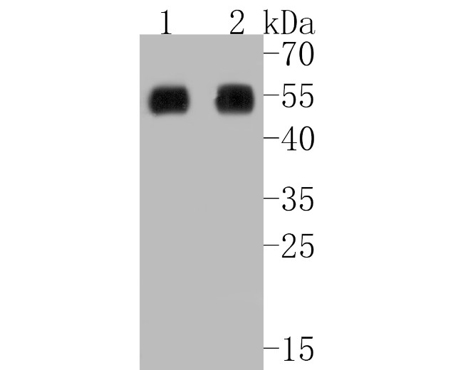 RIP3 Antibody in Immunohistochemistry (Paraffin) (IHC (P))