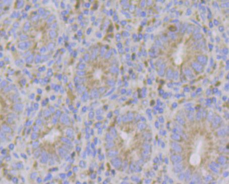 ERN1 Antibody in Immunohistochemistry (Paraffin) (IHC (P))