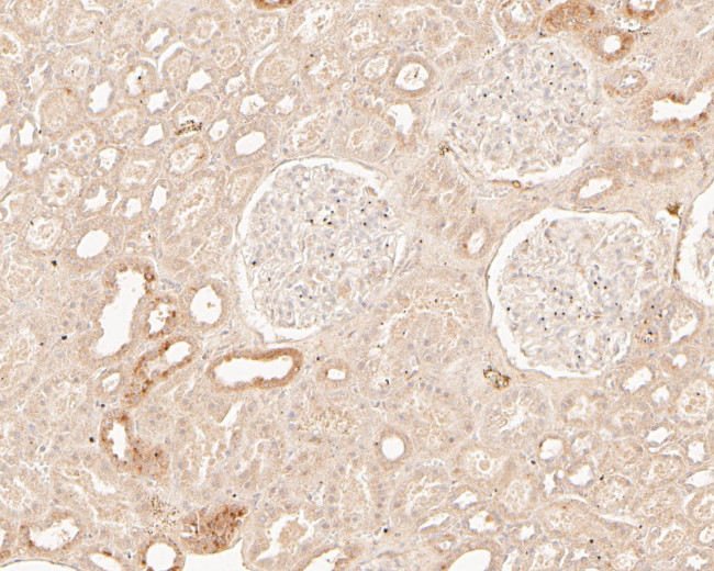 TREM2 Antibody in Immunohistochemistry (Paraffin) (IHC (P))