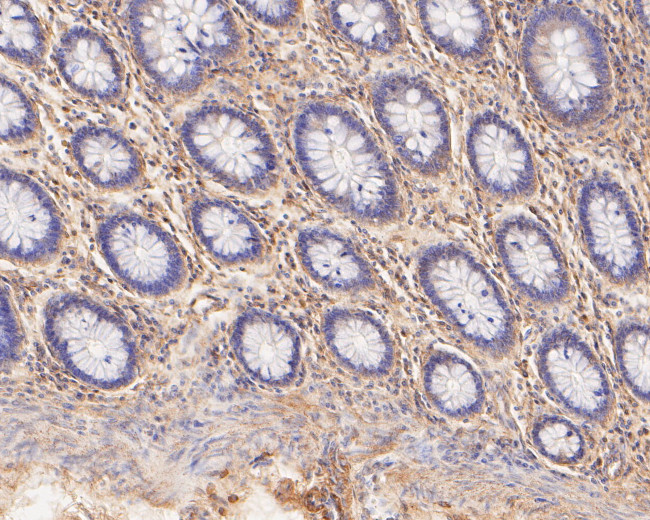 TREM2 Antibody in Immunohistochemistry (Paraffin) (IHC (P))