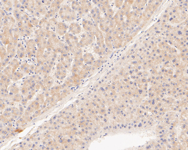 TREM2 Antibody in Immunohistochemistry (Paraffin) (IHC (P))