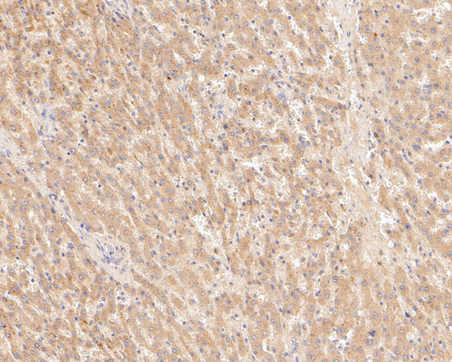 TREM2 Antibody in Immunohistochemistry (Paraffin) (IHC (P))