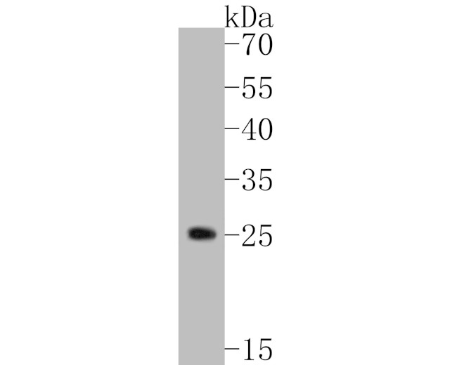 TREM2 Antibody in Western Blot (WB)