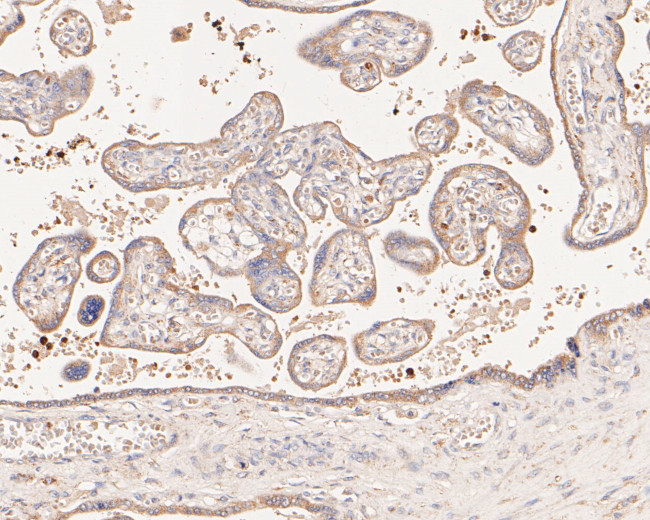 Flt3 Antibody in Immunohistochemistry (Paraffin) (IHC (P))