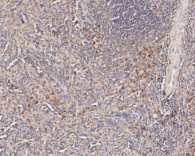 Flt3 Antibody in Immunohistochemistry (Paraffin) (IHC (P))