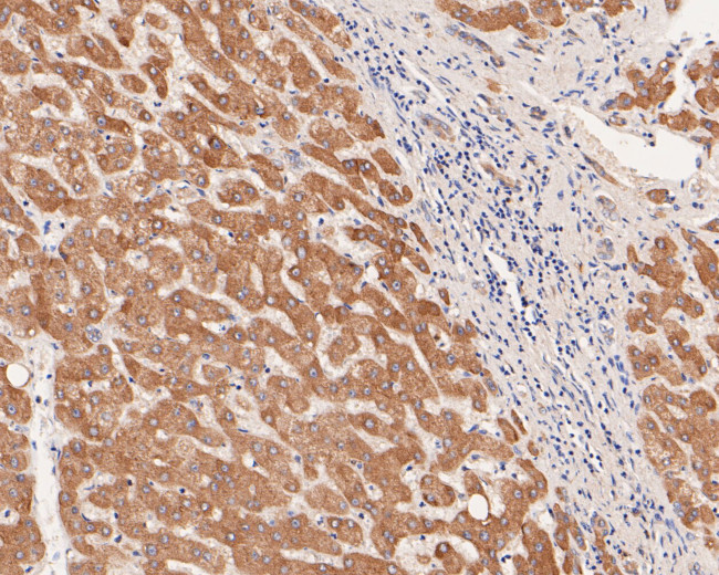 Flt3 Antibody in Immunohistochemistry (Paraffin) (IHC (P))