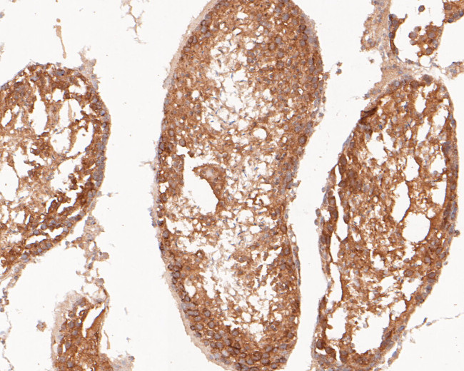 Flt3 Antibody in Immunohistochemistry (Paraffin) (IHC (P))