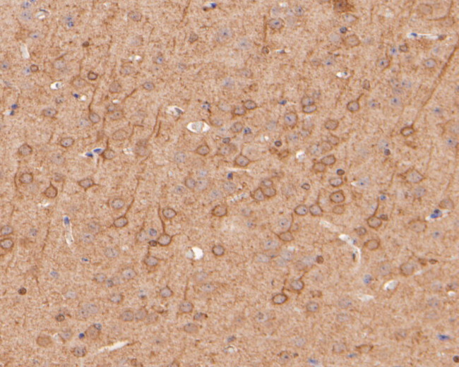 EPHA2 Antibody in Immunohistochemistry (Paraffin) (IHC (P))