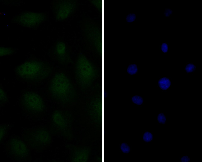 Androgen Receptor Antibody in Immunocytochemistry (ICC/IF)