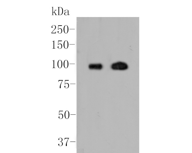 Androgen Receptor Antibody in Western Blot (WB)