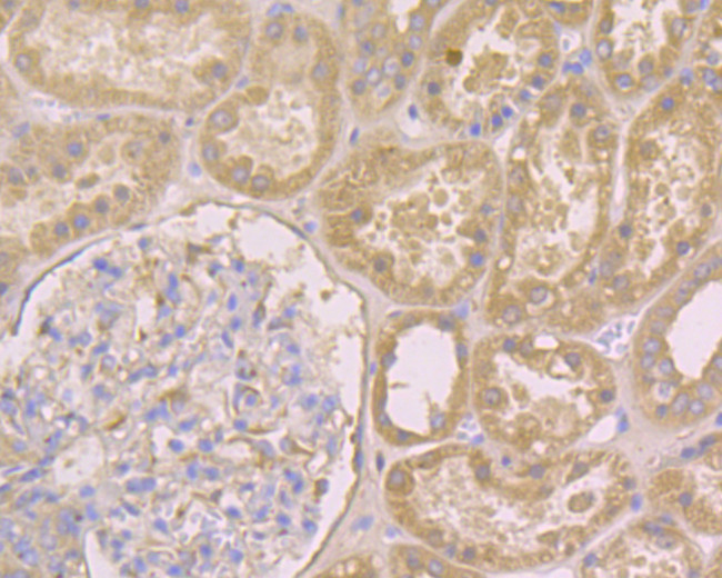 IRS1 Antibody in Immunohistochemistry (Paraffin) (IHC (P))