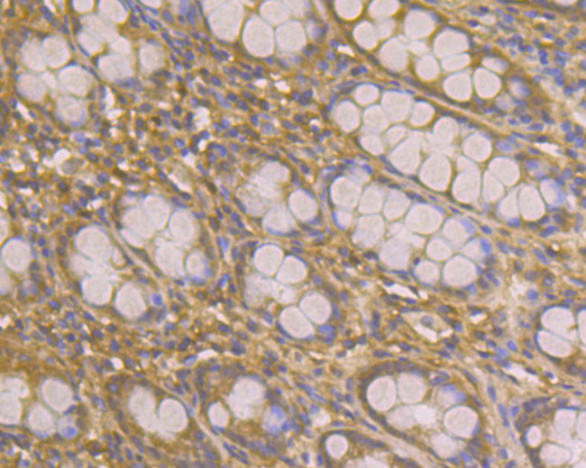 IRS1 Antibody in Immunohistochemistry (Paraffin) (IHC (P))