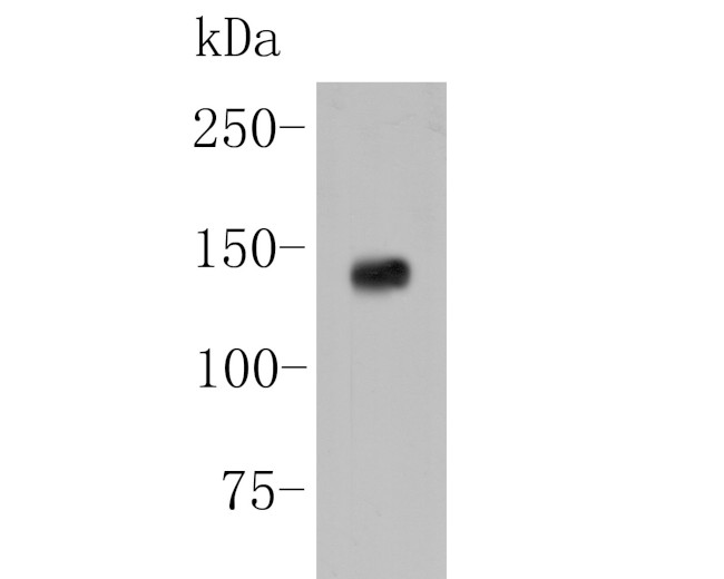 IRS1 Antibody in Western Blot (WB)