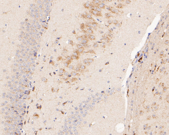 P2RX5 Antibody in Immunohistochemistry (Paraffin) (IHC (P))