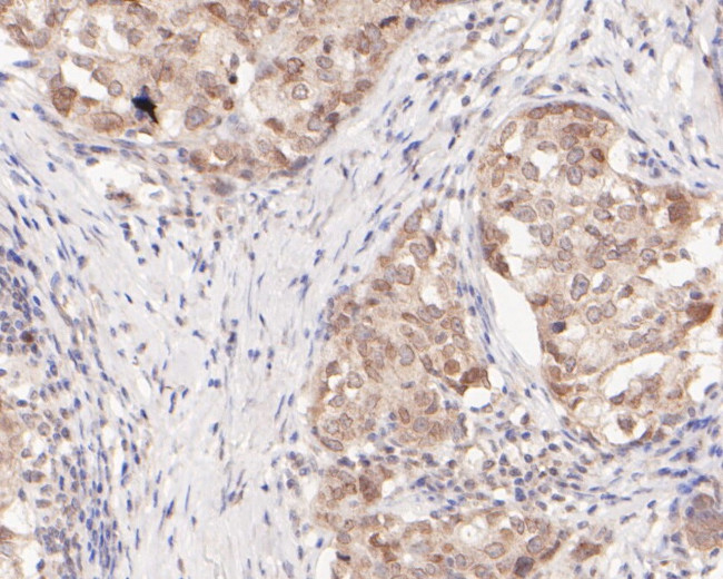 Nucleoporin p62 Antibody in Immunohistochemistry (Paraffin) (IHC (P))