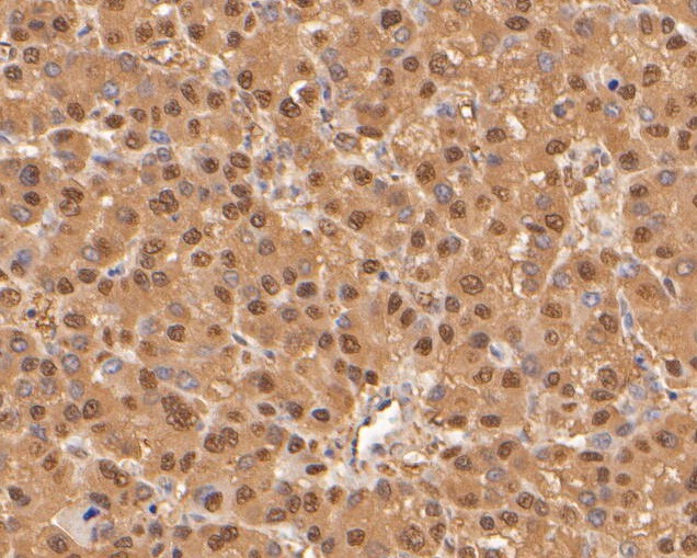 PSMA5 Antibody in Immunohistochemistry (Paraffin) (IHC (P))