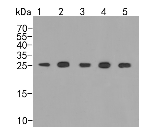 PSMA5 Antibody in Western Blot (WB)