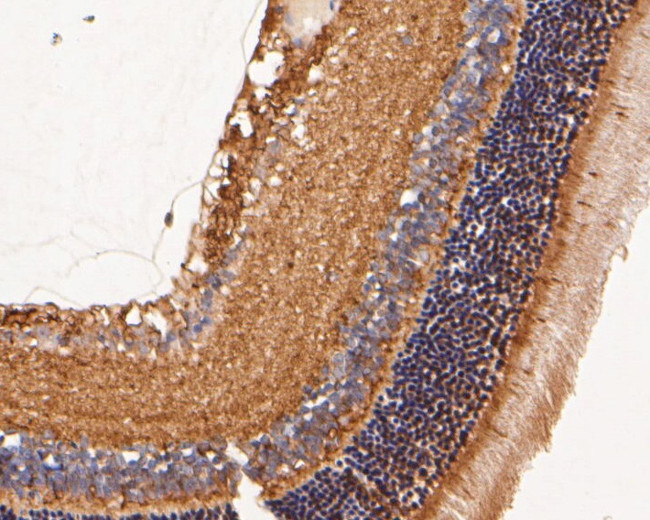 GRK1 Antibody in Immunohistochemistry (Paraffin) (IHC (P))