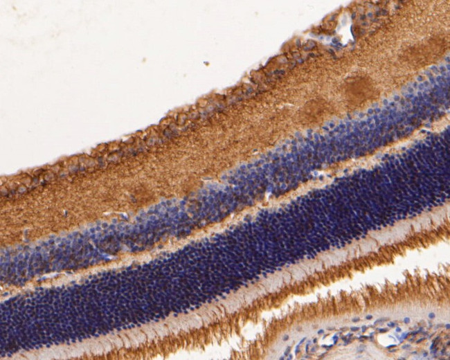 GRK1 Antibody in Immunohistochemistry (Paraffin) (IHC (P))