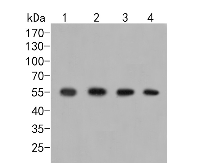 GRK1 Antibody in Western Blot (WB)