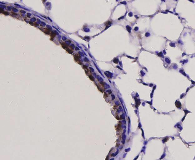 TLR7 Antibody in Immunohistochemistry (Paraffin) (IHC (P))