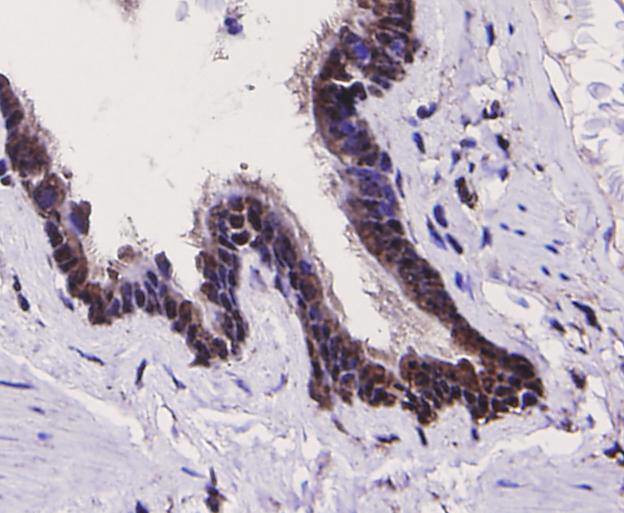 TLR7 Antibody in Immunohistochemistry (Paraffin) (IHC (P))