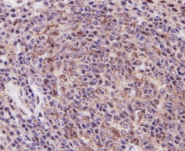 TLR7 Antibody in Immunohistochemistry (Paraffin) (IHC (P))