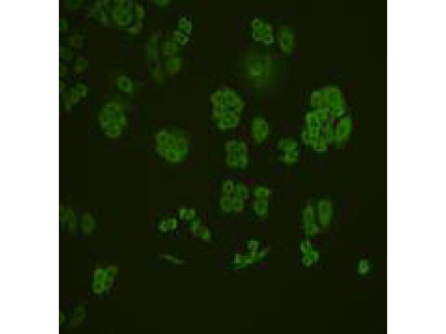 MMP1 Antibody in Immunocytochemistry (ICC/IF)