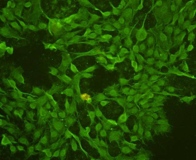 Topoisomerase II alpha Antibody in Immunocytochemistry (ICC/IF)