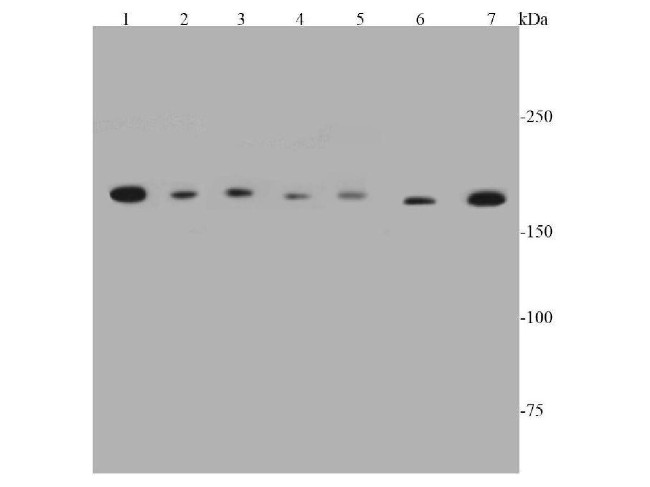 Topoisomerase II alpha Antibody in Western Blot (WB)