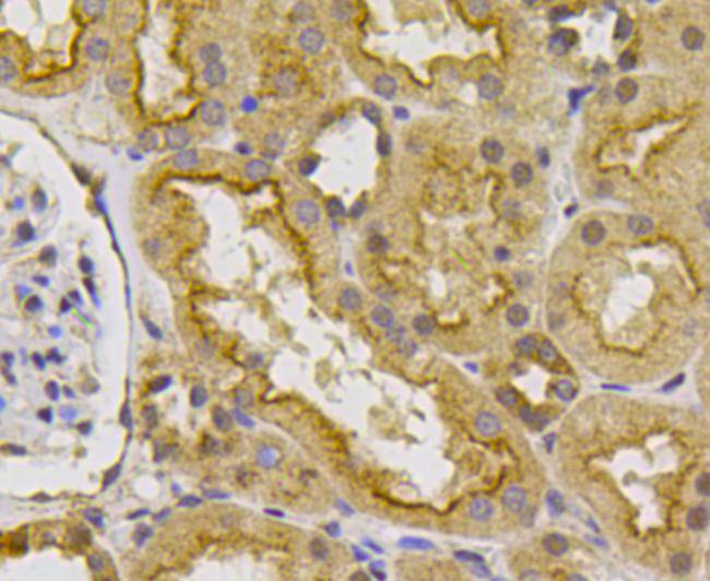 VEGFR1 Antibody in Immunohistochemistry (Paraffin) (IHC (P))