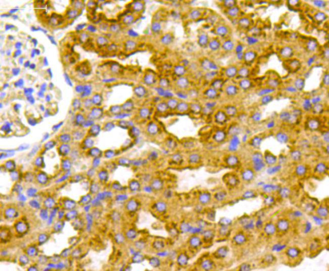 VEGFR1 Antibody in Immunohistochemistry (Paraffin) (IHC (P))