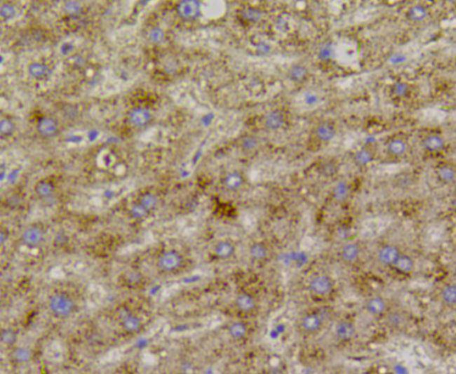 VEGFR1 Antibody in Immunohistochemistry (Paraffin) (IHC (P))