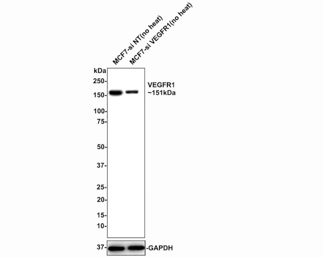 VEGFR1 Antibody in Immunohistochemistry (Paraffin) (IHC (P))