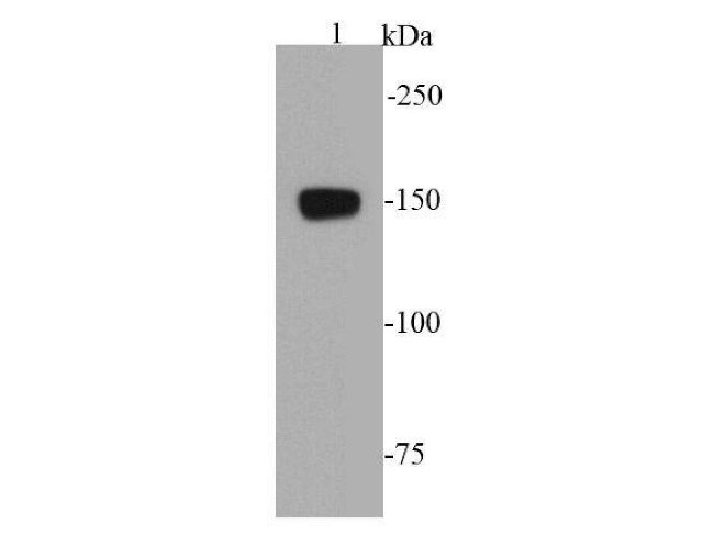 VEGFR1 Antibody in Western Blot (WB)