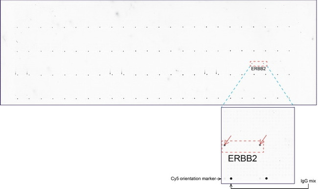 ERBB2 Antibody in Peptide array (ARRAY)