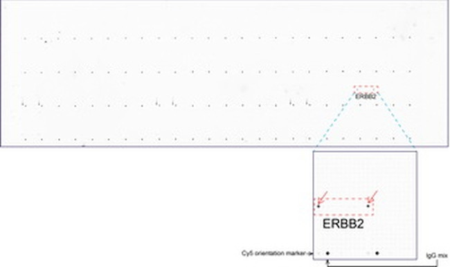 ERBB2 Antibody in Peptide array (ARRAY)